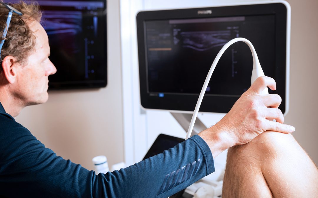 Nieuwe internationale richtlijn bevestigt waarde van shockwavetherapie (ESWT) in de sportgeneeskunde